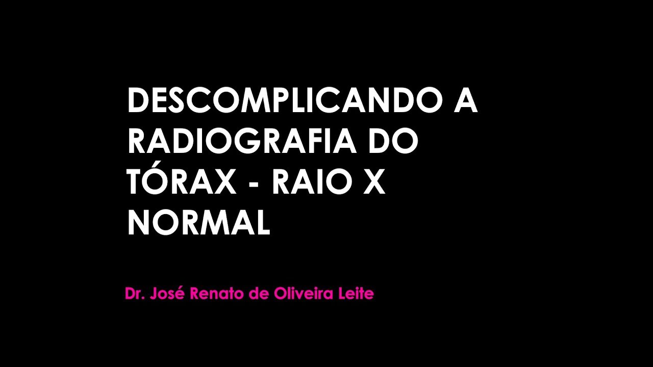 DESCOMPLICANDO A RADIOGRAFIA DO TÓRAX - RAIO X NORMAL