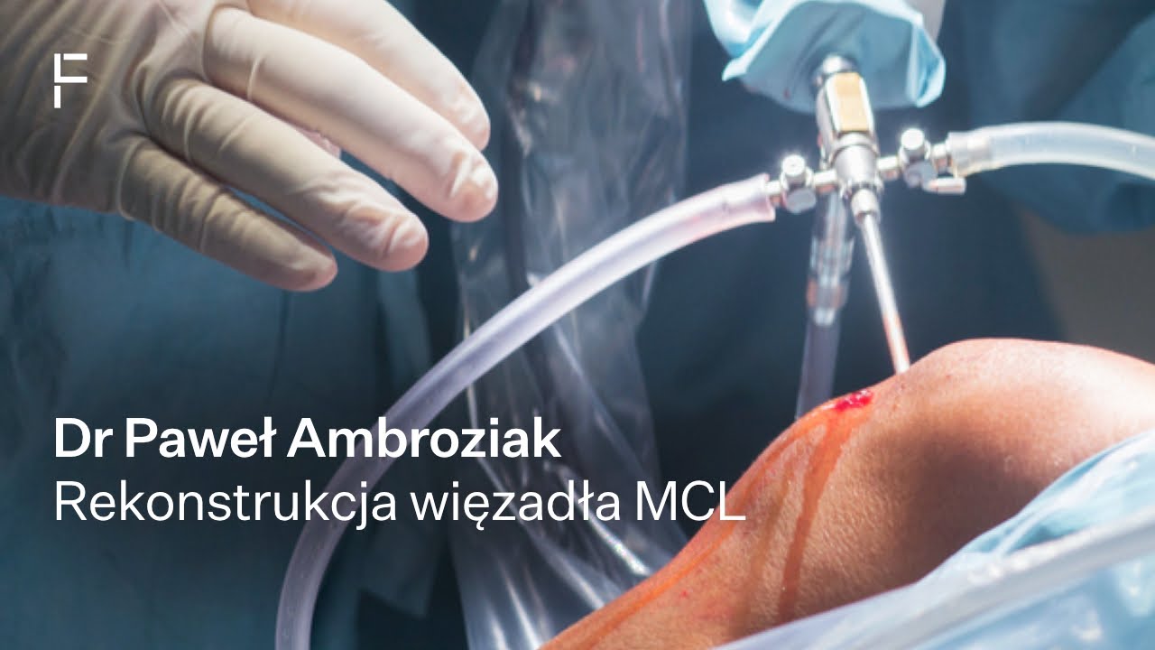 Uszkodzenia i leczenie więzadła pobocznego piszczelowego MCL