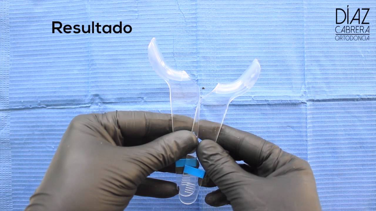 Tips para Fotografía Clínica en Odontología