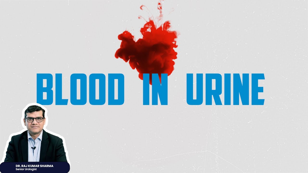 Blood in urine : 90% लोग देर कर देते हैं! आप मत करें
