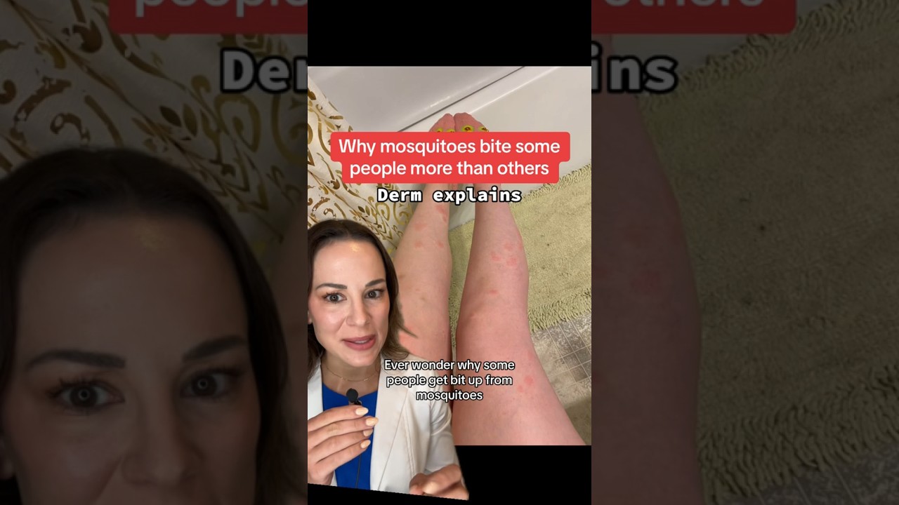 Why Do Mosquitoes Bite Some People More Than Others? &ndash; Derm Explains | #shorts #skincare |