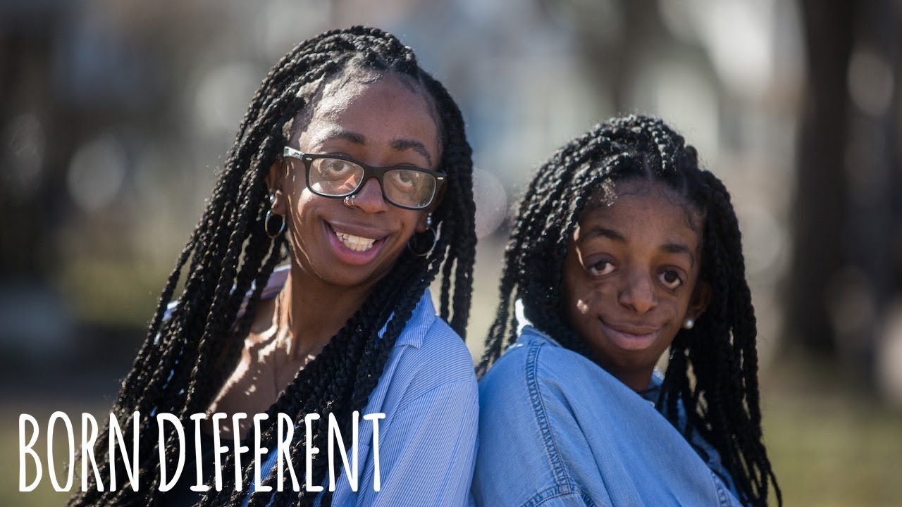 Inspirational Sisters Share Rare Facial Disorder | BORN DIFFERENT