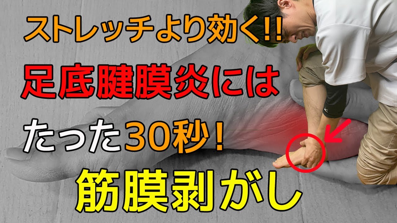 【30秒！足底腱膜炎治し方】ストレッチで治らない足底腱膜炎は、筋膜リリースで足の裏の痛みを改善！【足底筋膜炎治療】