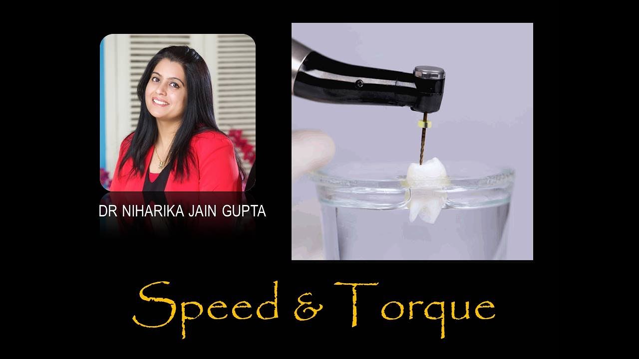 Speed & Torque in Rotary Endodontics