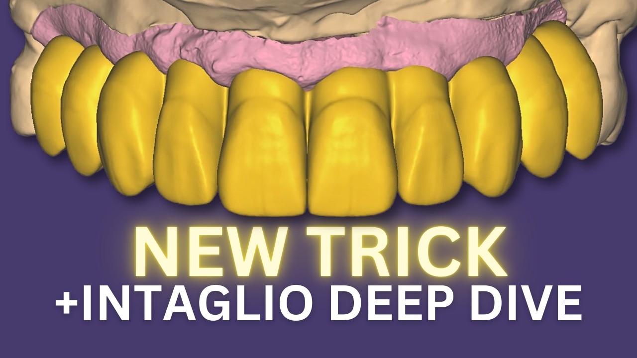 NEW TRICK = SAVE TIME & MAKE You RICH. + INTAGLIO EXPLAINED (In Detail) EXOCAD 2025