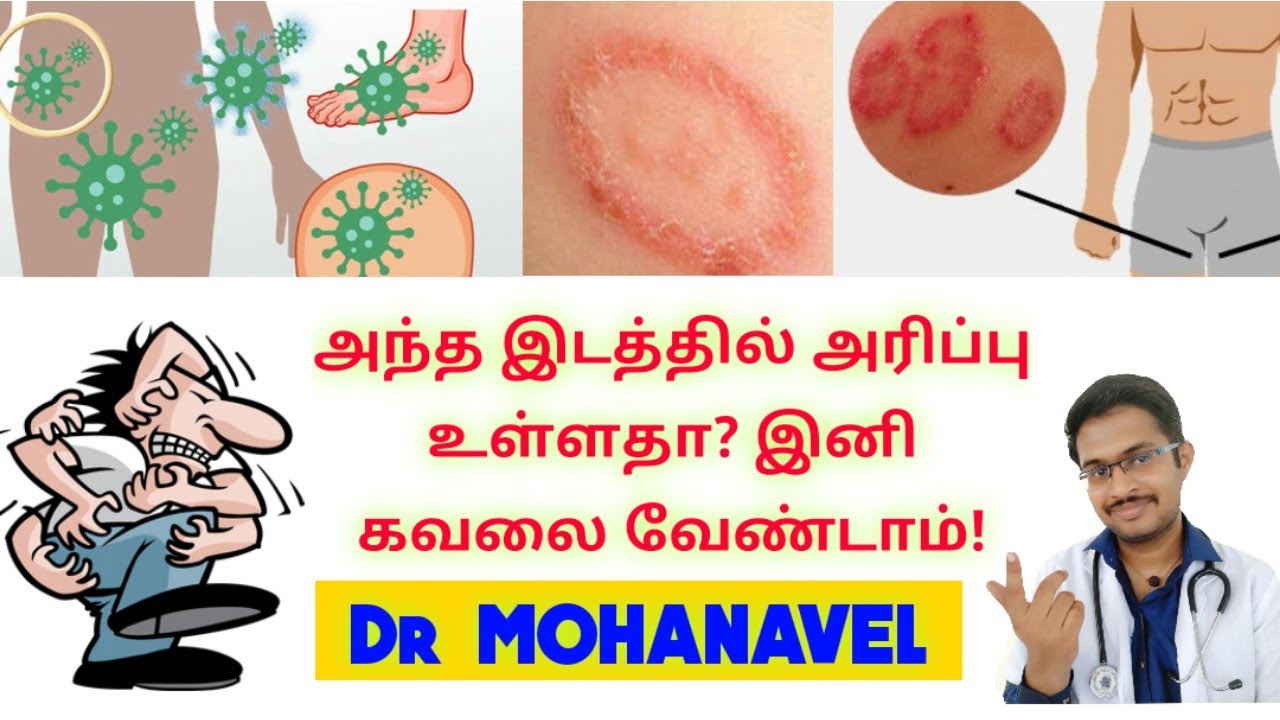 படர்தாமரை அரிப்பு குணமாக_Jock Itch_Causes Symptoms Prevention Natural Cure Tamil-Dr MOHANAVEL