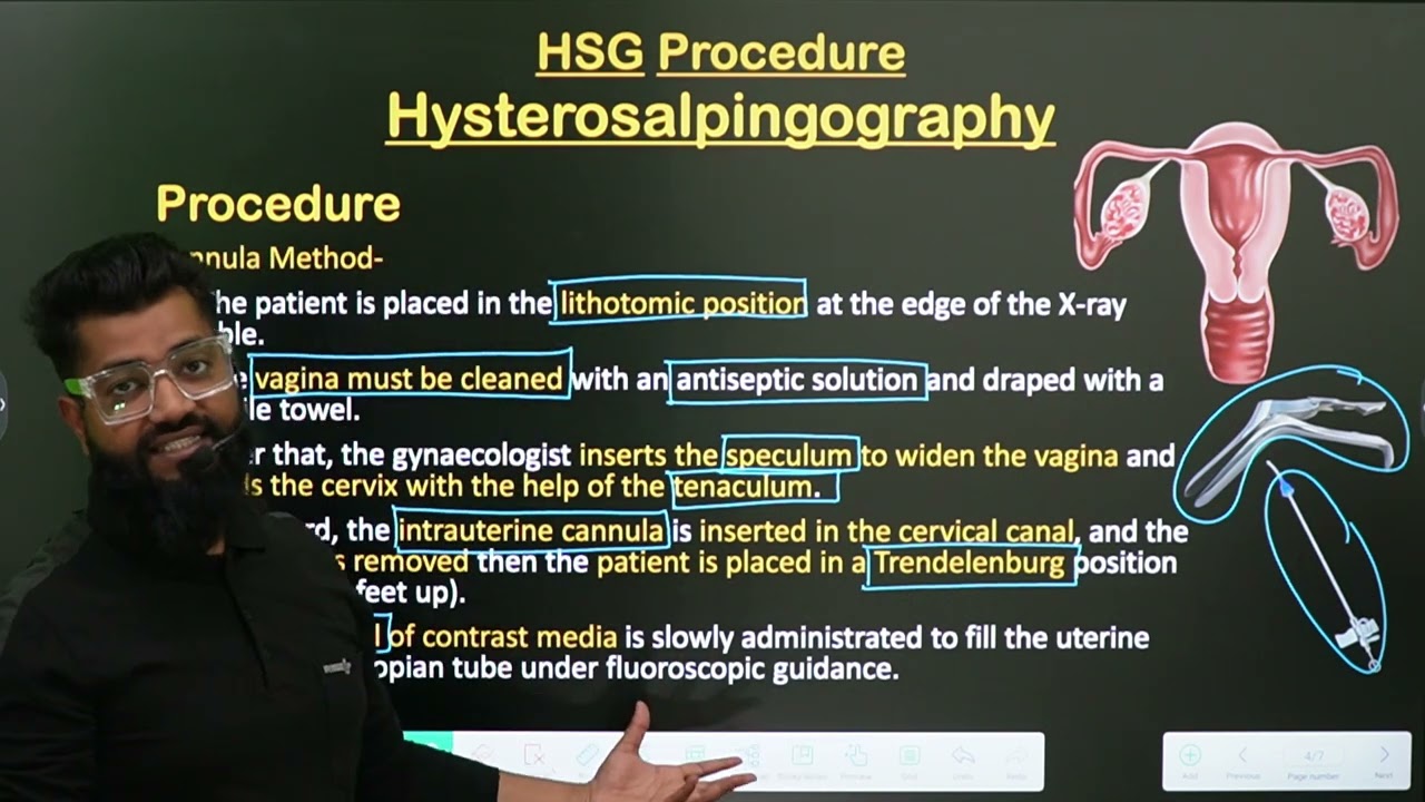 HSG Procedure || Hysterosalpingography || Part-2 || in Hindi || Radiology Procedure ||
