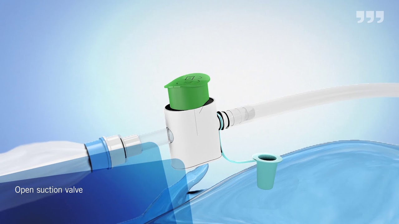 OptiFlo Closed Suction for Ventilated Patients