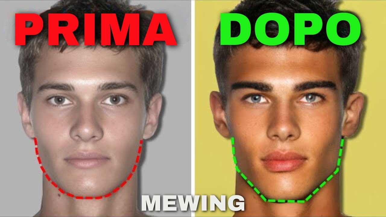 Mewing: il segreto per una Mascella perfetta