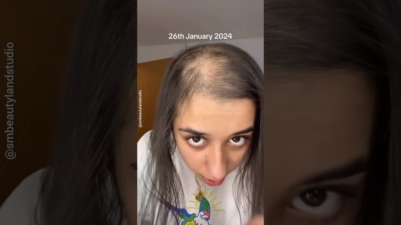 🔥Best Homemade Hair Oil For Extream Hair Fall😱✅ #shorts #smbeautylandstudio Smbeautylandstudio