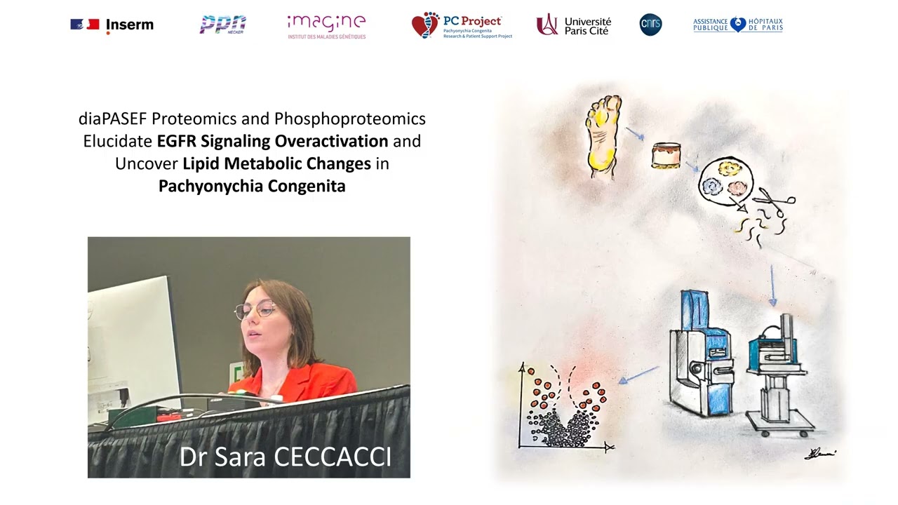 Pachyonychia Congenita represented at ASMS 2025