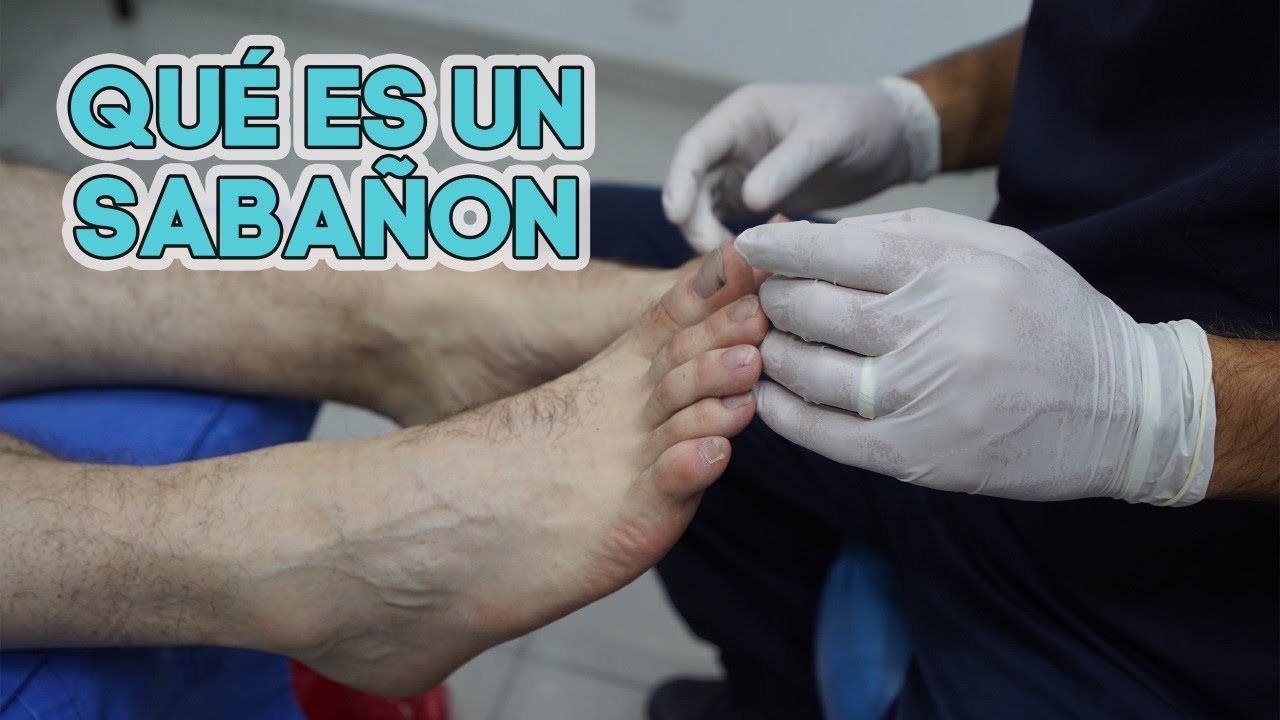 &iquest;Qu&eacute; es un saba&ntilde;&oacute;n?