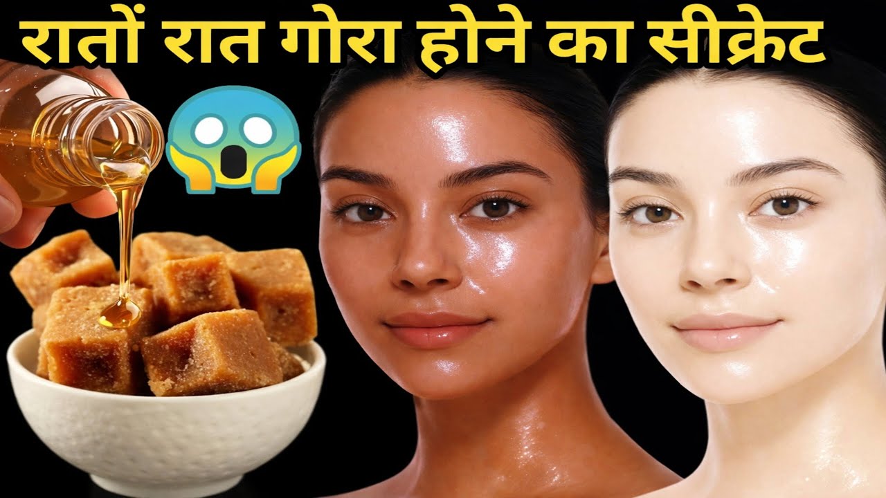 गुड़ का जादू झाइयों वाले काले चेहरे से मिला छुटकारा , अब चेहरा हीरे सा चमकता है घर वाले भी हैरान है