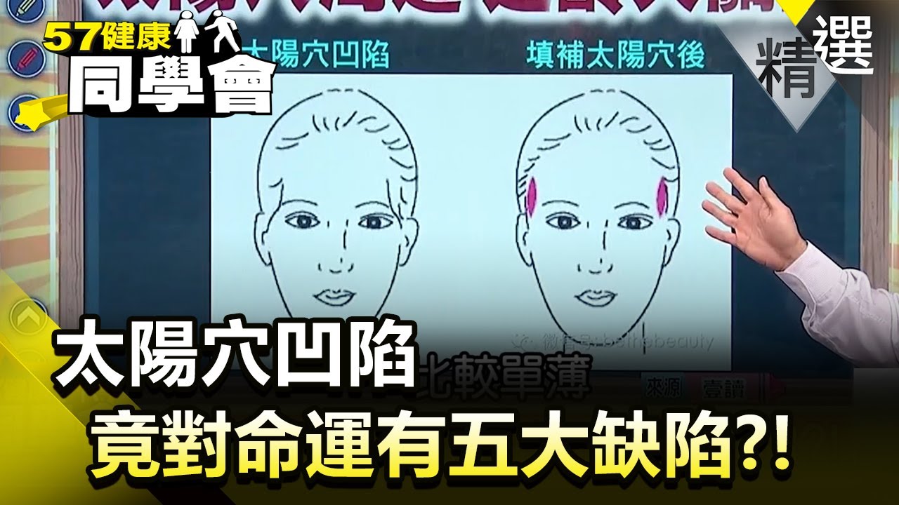 太陽穴凹陷 竟對命運有五大缺陷？！【健康同學會】精華篇｜隋安德 許晶晶