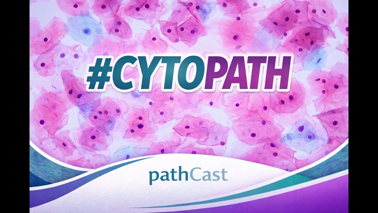 The atypical thyroid FNA - Dr. Cibas (BWH) #CYTOPATH