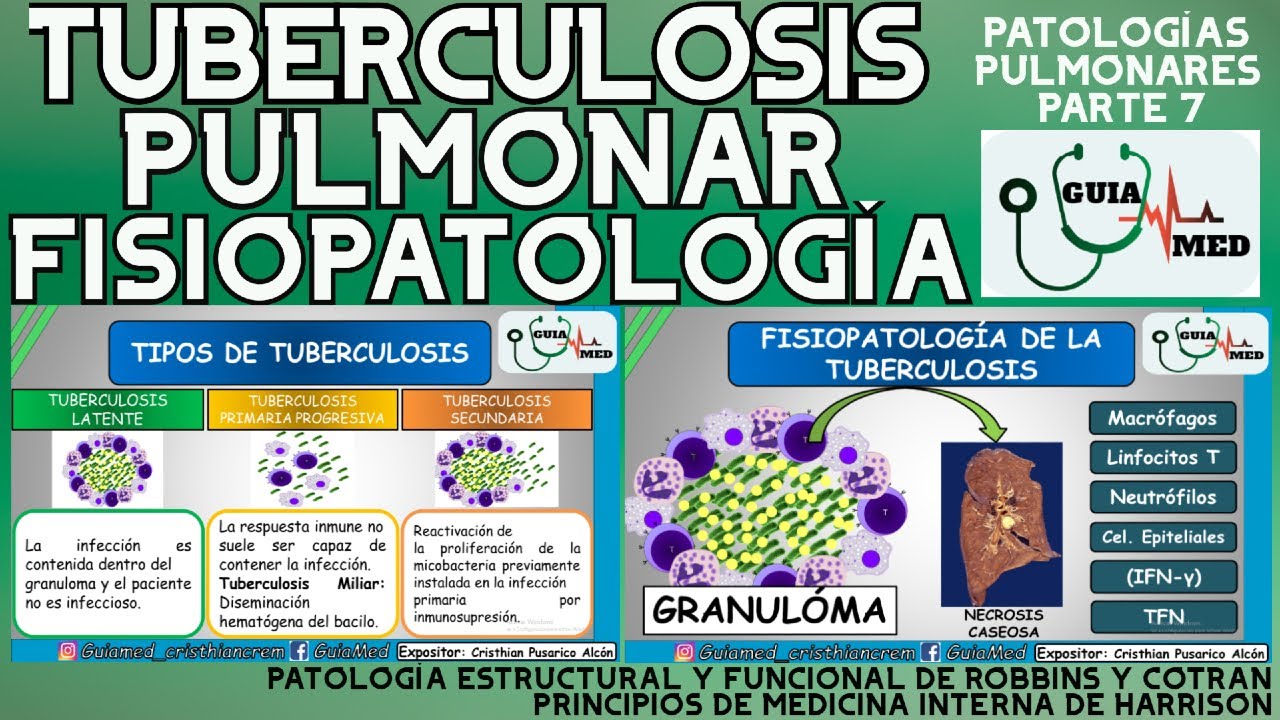 TUBERCULOSIS PULMONAR FISIOPATOLOGÍA| GuiaMed
