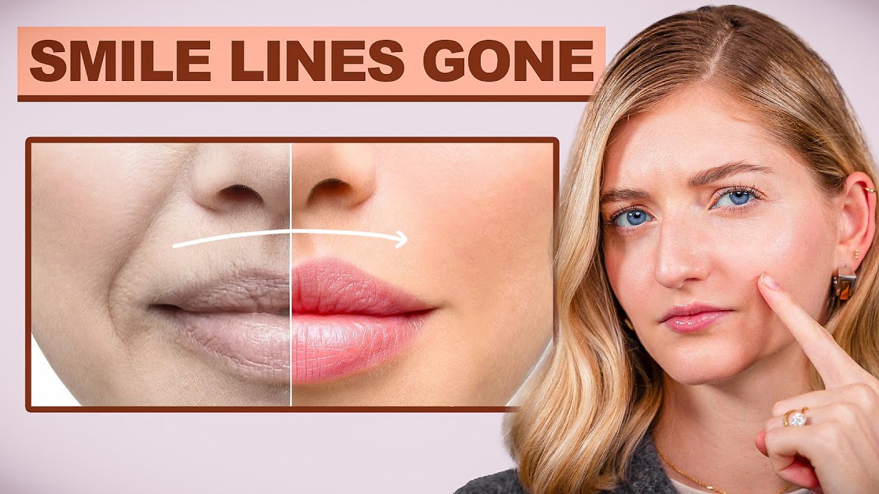 I'm Shocked! Fillers DON'T Fix Smile Lines (Press THIS Point Instead!) 😮