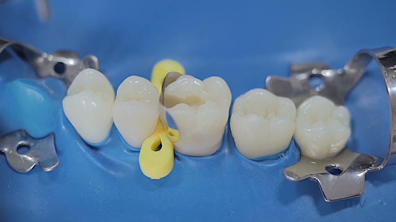 Sistema Unimatrix R – TDV a Septodont Company