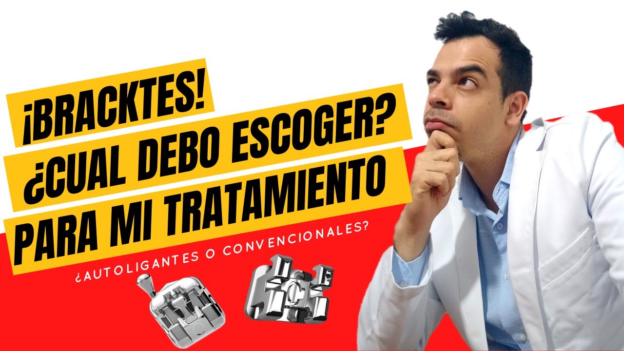 TIPOS DE BRACKETS | ¿CUÁLES SON MEJORES? / COSTO - BENEFICIO