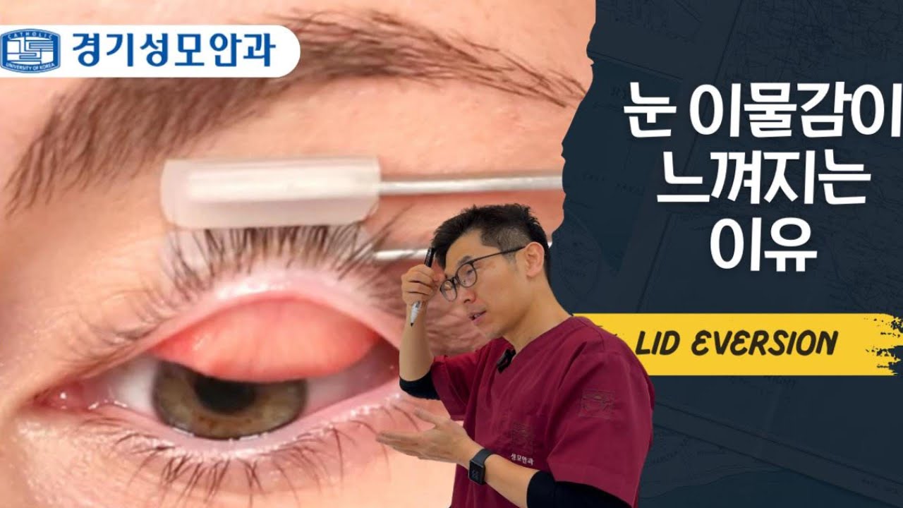눈 이물감이 느껴지는 이유 #lideversion #경기성모안과 #평택안과