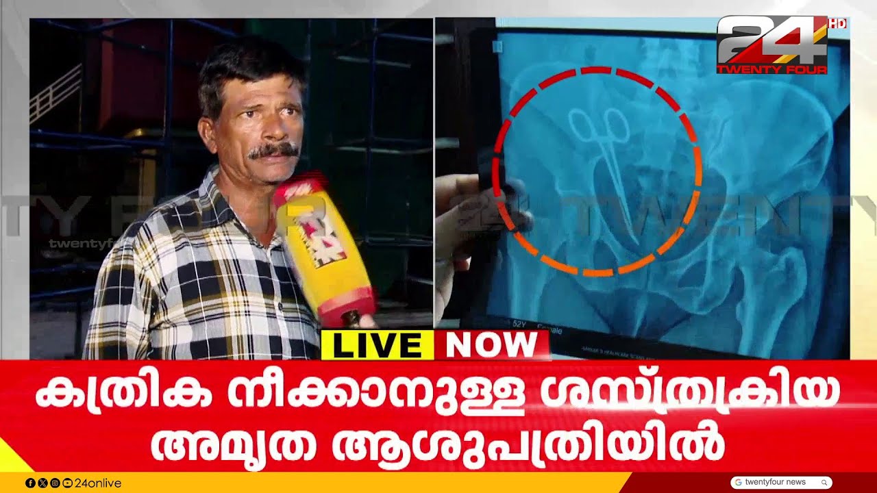 വണ്ടാനം മെഡിക്കൽ കോളജിലെ ചികിത്സാപ്പിഴവ്; ഉഷ ജോസഫിന്റെ ശസ്ത്രക്രിയ ഉടൻ