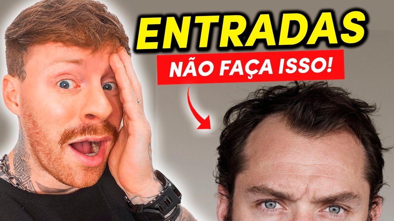 ENTRADAS NO CABELO: 5 Estilos de CORTES MASCULINOS ANIMAIS pra você Aderir!