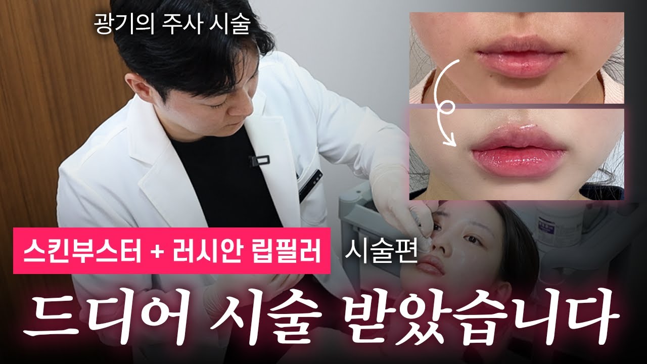 [ep.2] 러시안 립필러&목주름 필러&스킨부스터, 한 번에 다 받아봄 (시술 꿀팁도 대방출🥴) 안 보면 후회함