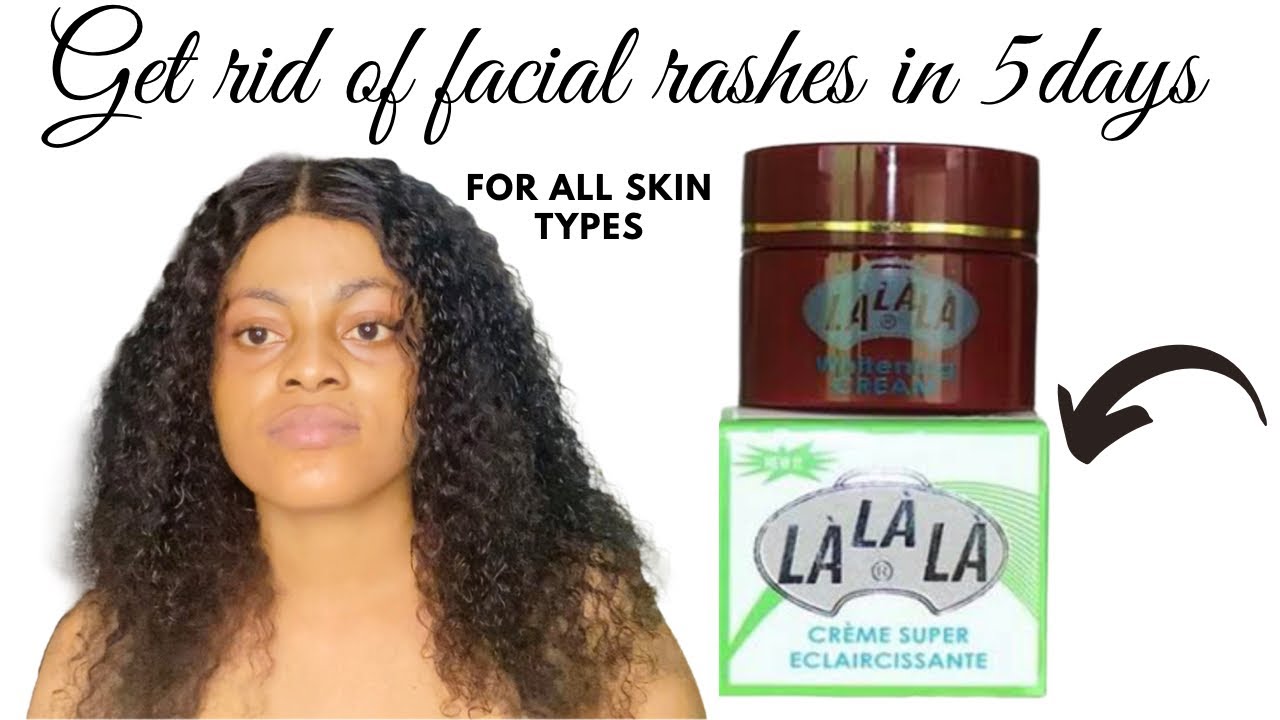 Honest review on lalala face cream | for all skin types| lalala review, best face cream