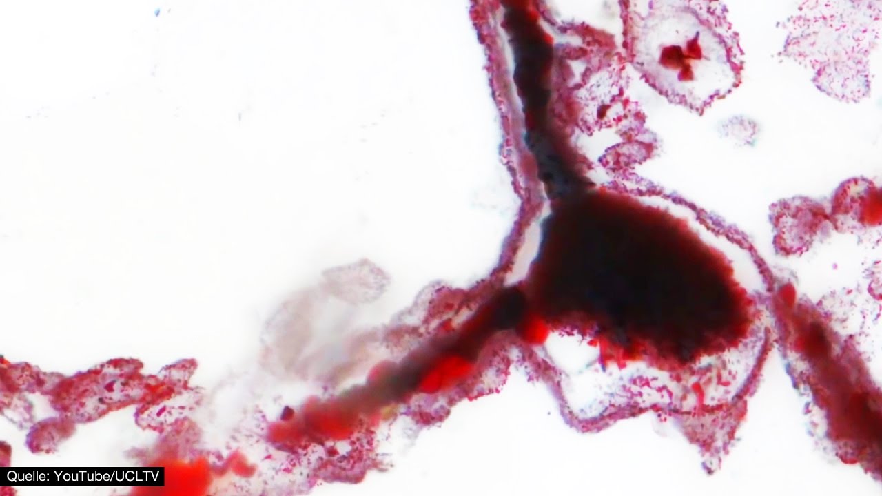 Fossilien geben Hinweise auf Außerirdisches Leben! - Clixoom Science & Fiction