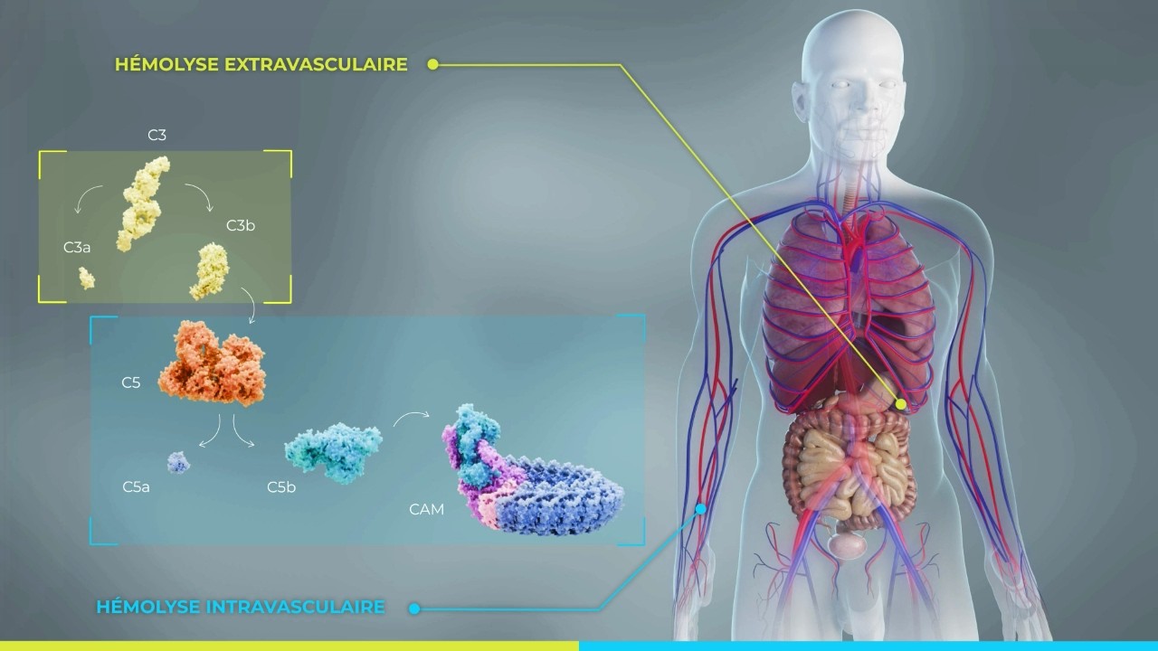 Comprendre l’hémolyse dans l’HPN : HIV et HEV expliquées