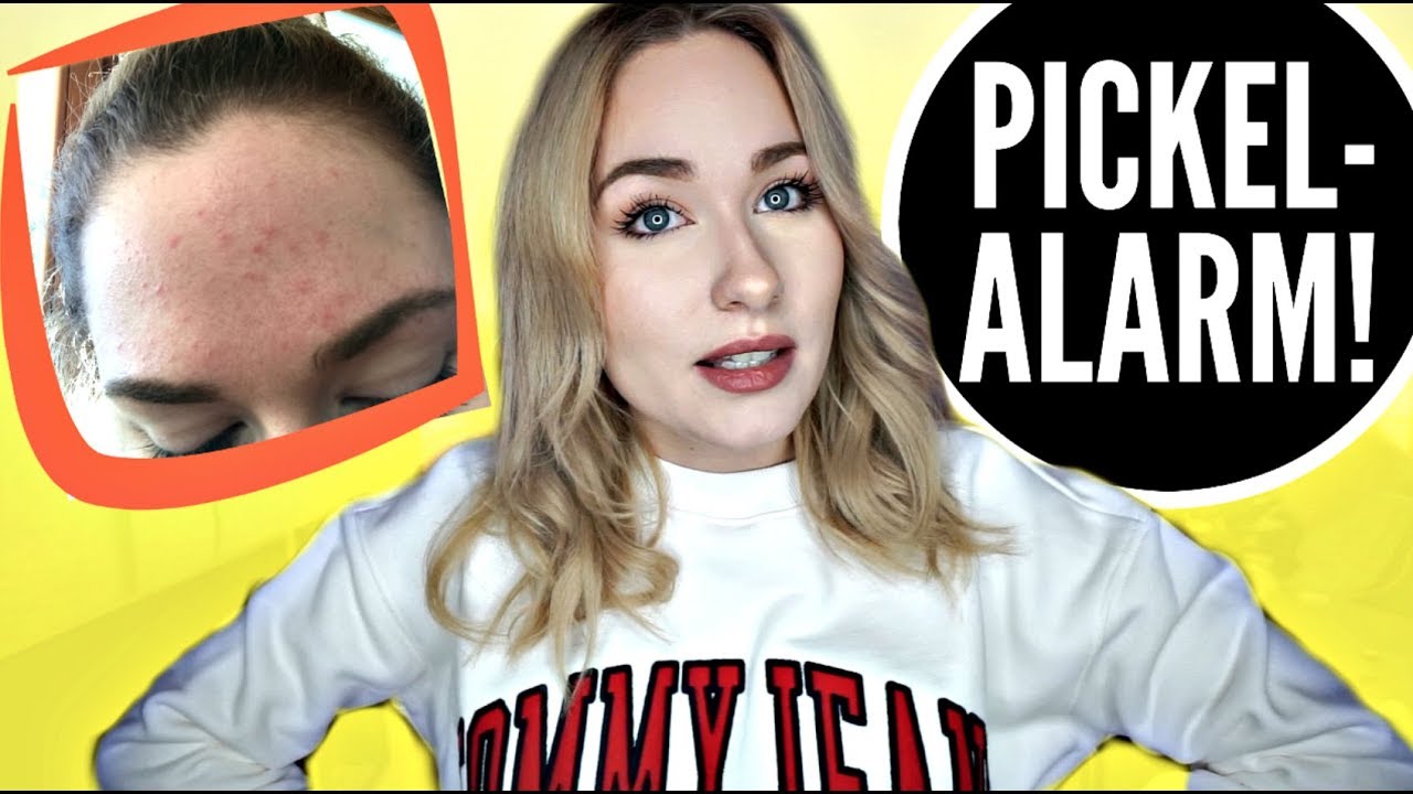 PILLE ABGESETZT! | SO GEHT ES MIR 1 Monat OHNE die PILLE | Sonny Loops
