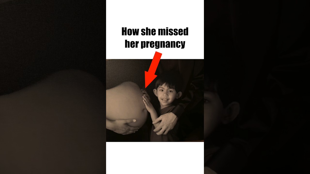 How 2 Doctors Missed Their Pregnancy..😬 #doctorrich #drrich #crypticpregnancy