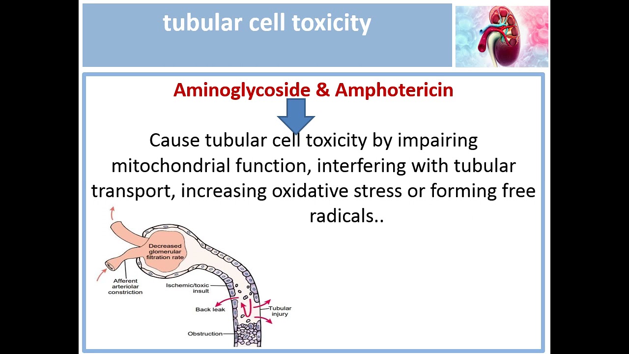 Nephrotoxic drugs - By Dr. Azza Abouelella