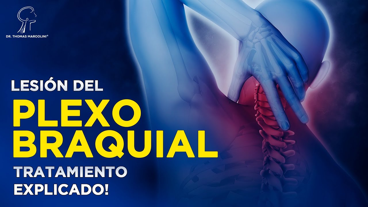 Cómo Recuperar la Fuerza del Brazo: Tratamiento de la Lesión del Plexo Braquial!
