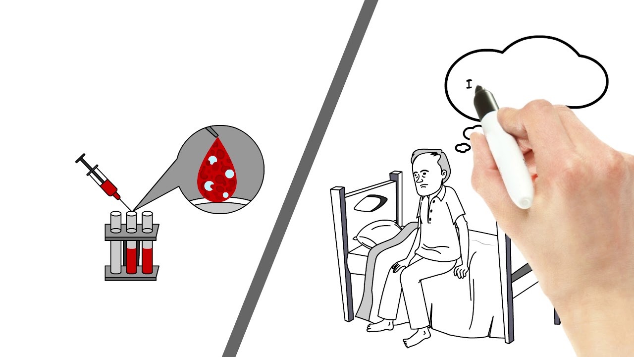Our CLL Journey: (1) What is CLL?