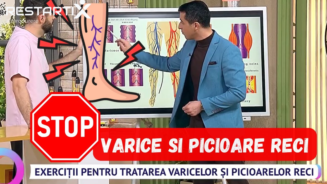 🦶️Exerciții pentru tratarea varicelor și picioarelor reci | Fiz. Alexandru Ilie RestartiX