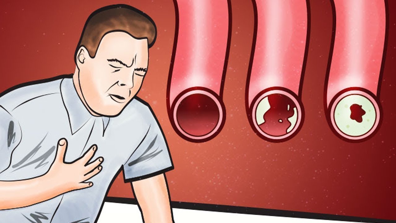 Diese Lebensmittel reinigen deine Arterien