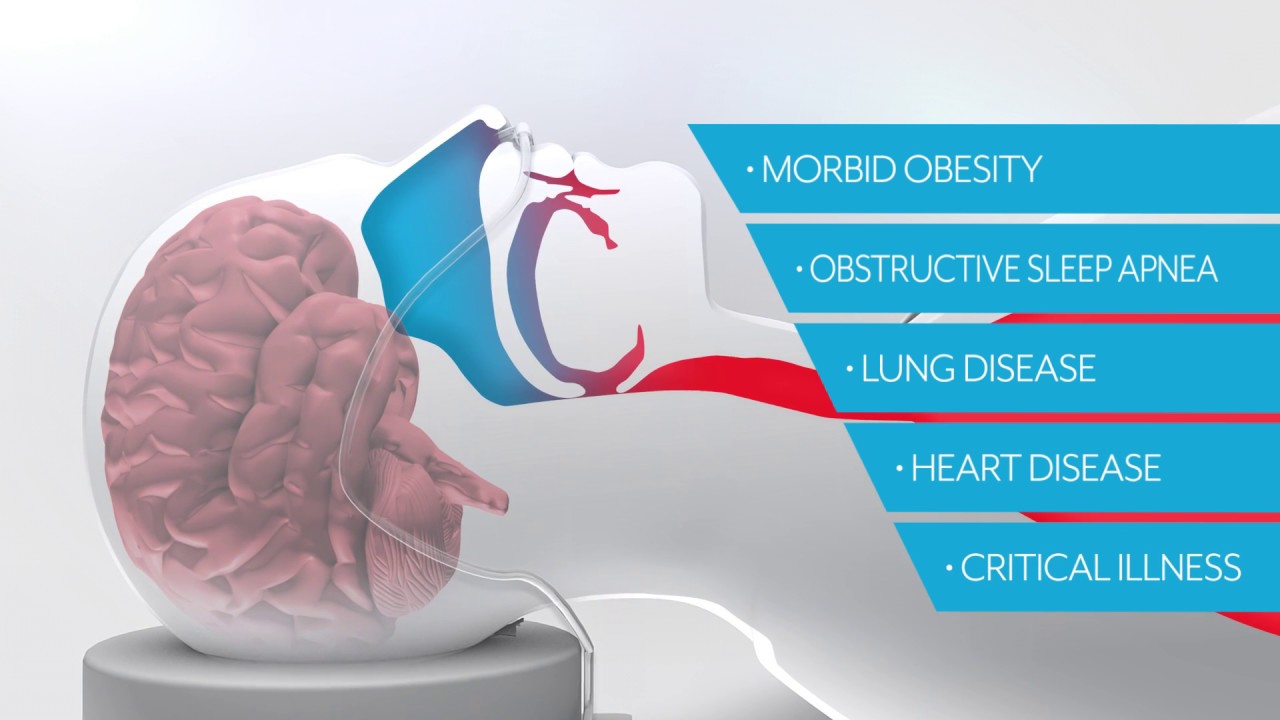 Medical Device Animated Explainer Video | SuperNOVA