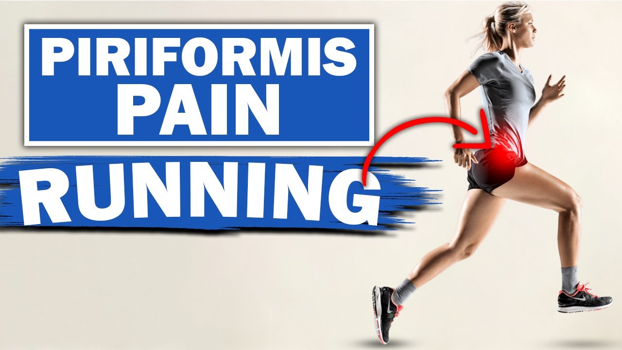 How To Treat Piriformis Syndrome When Running - A Simple Stretch