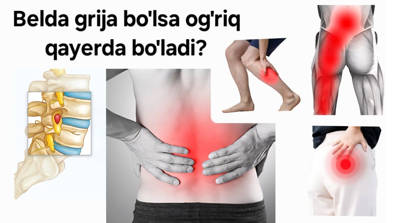 Belda grija bo'lsa og'riq qayerda bo'ladi?