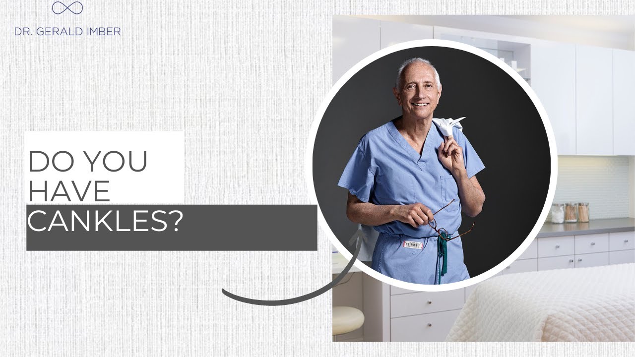 Do you know what &ldquo;cankles&rdquo; are? Dr. Imber discusses his solution to correct the problem!
