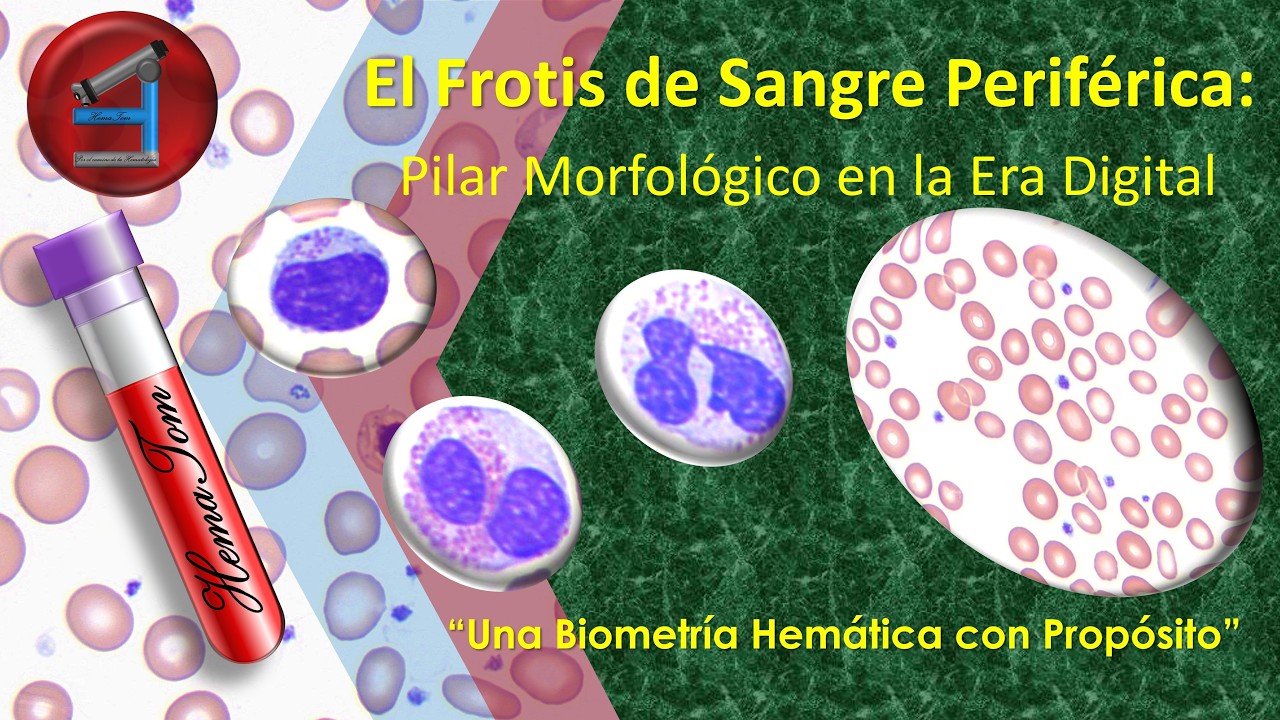 El Frotis de Sangre Periférica Pilar Morfológico en la Era Digital