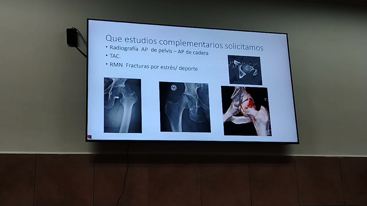 TEÓRICA TRAUMATOLOGÍA 18 DE FEBRERO DEL 2025
