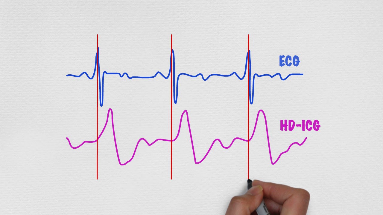 How to use HD-ICG US