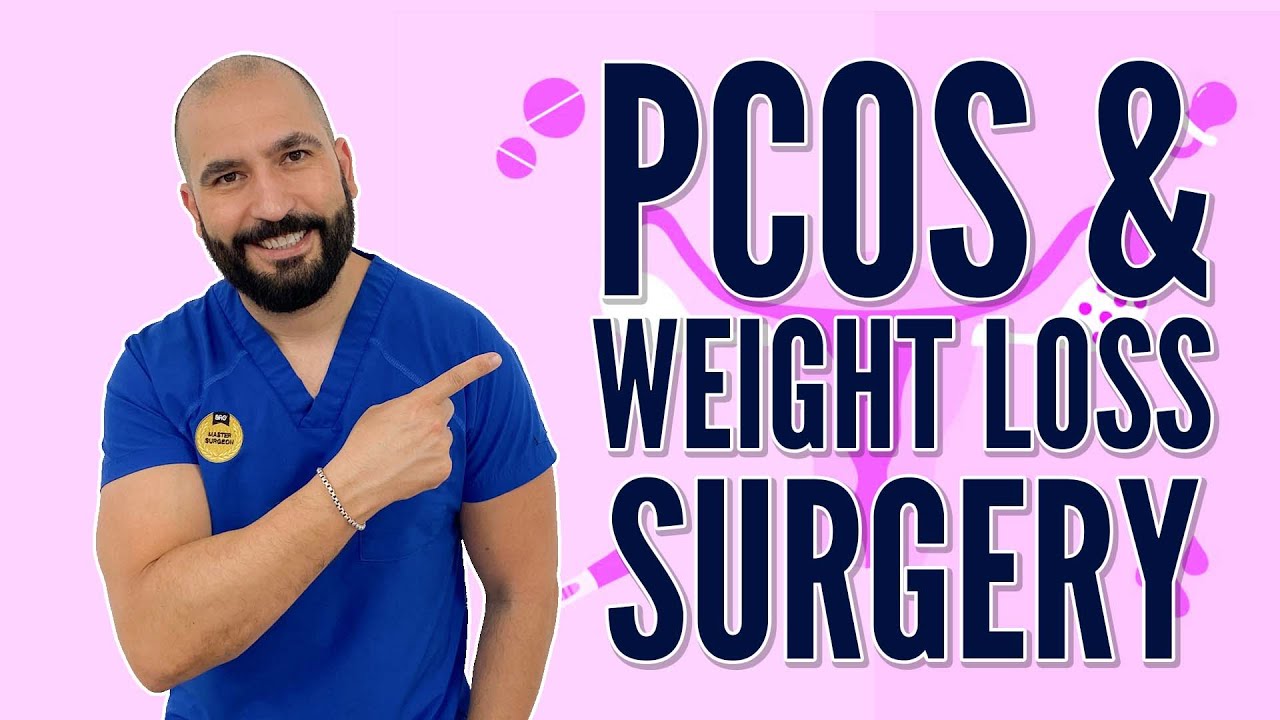 Polycystic Ovary Syndrome & Weight Loss Surgery | Gastric Sleeve Surgery | Questions and Answers