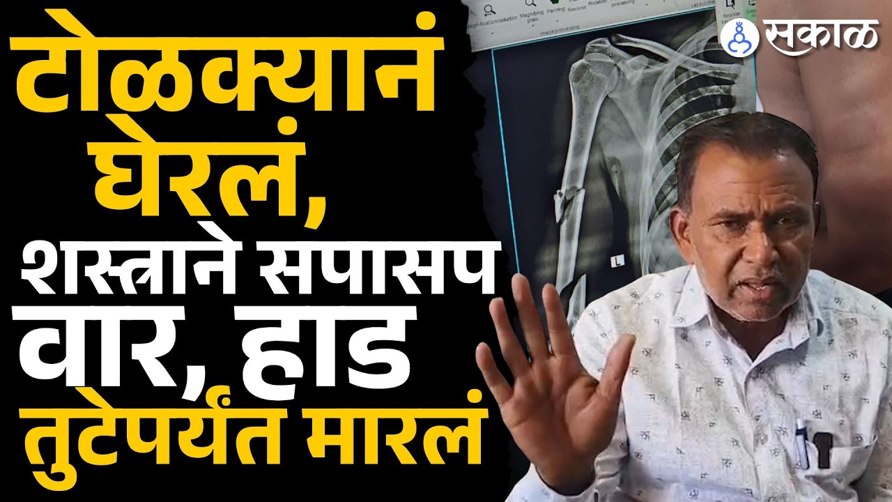 Beed news:  ३-४ जणांनी घेरलं, तरूणावर धारदार शस्त्राने वार करत लोखंडी रॉडने बेदम मारलं | Sakal |