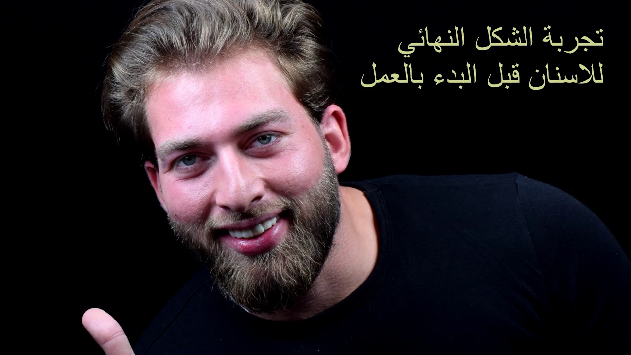 شاهد نتيجة الشاب عماد على يد الدكتور علي فاضل القرملي | مركز الغدير لطب الأسنان