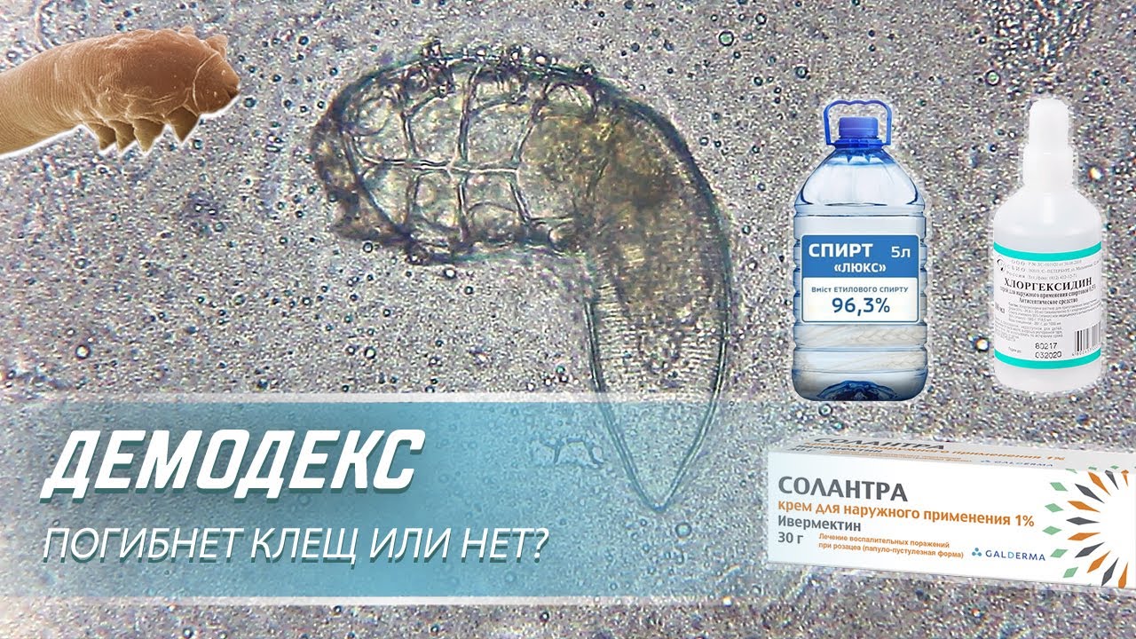 Клещ ДЕМОДЕКС против крема Солантра, спирта и Хлоргексидина|  Угревая Железница Demodex