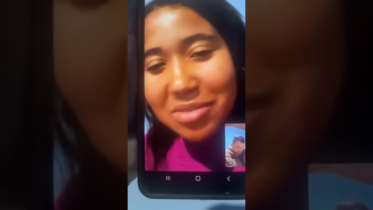 IMPRESSIONANTE, NARIZ SE ABRE AO VIVO MEU DEUS!!