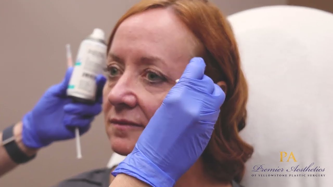 Kae Sukut, PA with Premier Aesthetics, explains the treatment and benefits of Sculptra